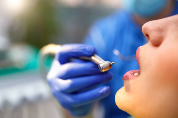 Dental Bonding in Pine Hills, CA